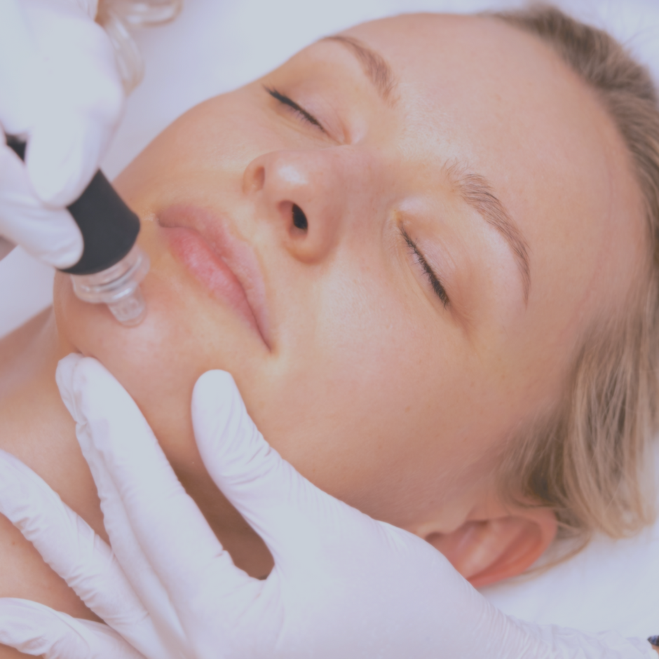 Why You Should Always Use Sunscreen After a Beauty Treatment